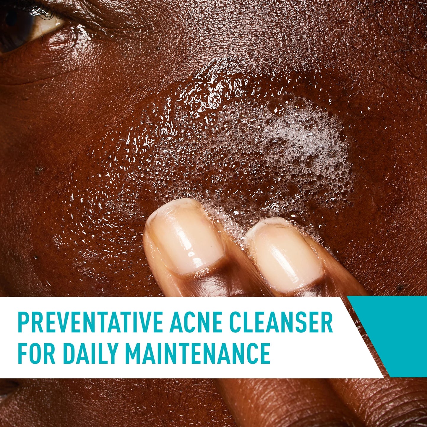 Skin Care Acne Control Face Cleanser with 2% Salicylic Acid Clears Acne Blackheads Pores